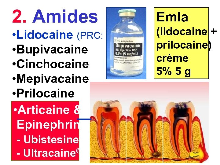 2. Amides • Lidocaine (PRC: B) • Bupivacaine • Cinchocaine • Mepivacaine • Prilocaine