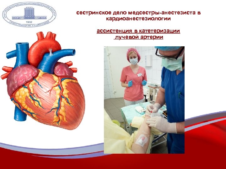 сестринское дело медсестры-анестезиста в кардиоанестезиологии ассистенция в катетеризации лучевой артерии 