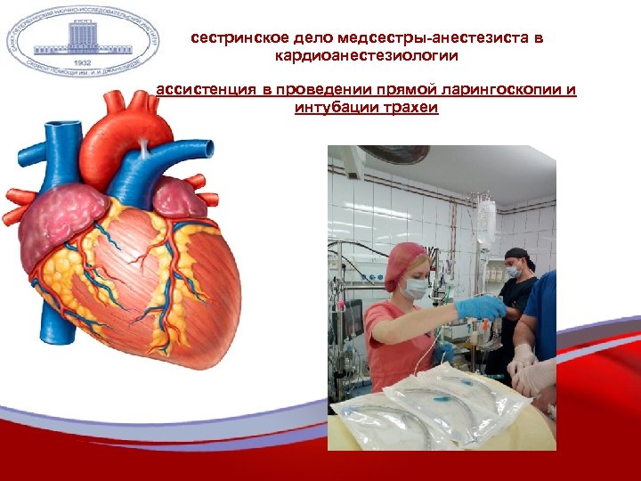 сестринское дело медсестры-анестезиста в кардиоанестезиологии ассистенция в проведении прямой ларингоскопии и интубации трахеи 