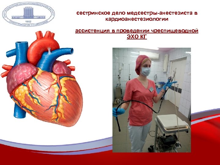 сестринское дело медсестры-анестезиста в кардиоанестезиологии ассистенция в проведении чреспищеводной ЭХО КГ 