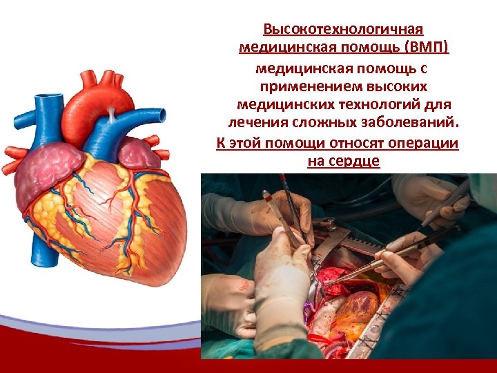  Высокотехнологичная медицинская помощь (ВМП) медицинская помощь с применением высоких медицинских технологий для лечения