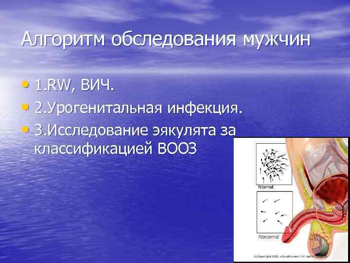 Алгоритм обследования мужчин • 1. RW, ВИЧ. • 2. Урогенитальная инфекция. • 3. Исследование