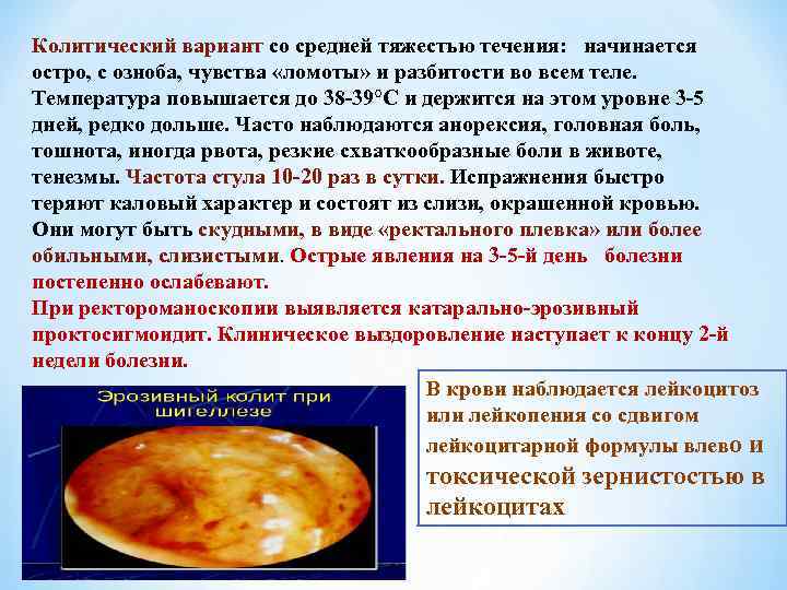 Колитический вариант со средней тяжестью течения: начинается остро, с озноба, чувства «ломоты» и разбитости