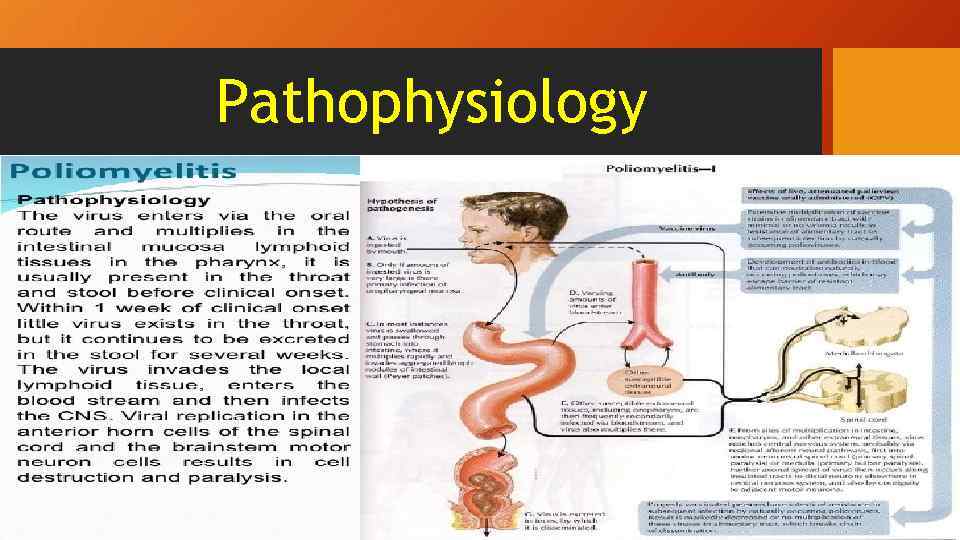 Pathophysiology 