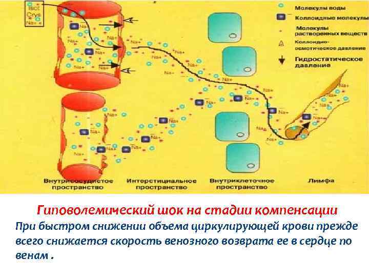 Гиповолемический шок на стадии компенсации При быстром снижении объема циркулирующей крови прежде всего снижается