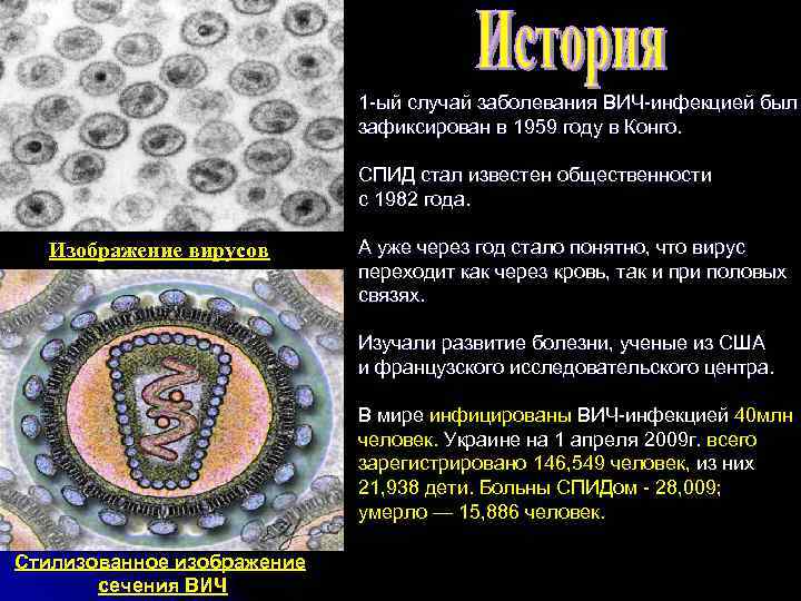 1 -ый случай заболевания ВИЧ-инфекцией был зафиксирован в 1959 году в Конго. СПИД стал