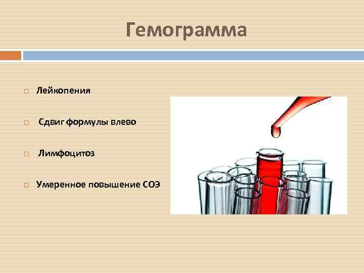 Гемограмма Лейкопения Сдвиг формулы влево Лимфоцитоз Умеренное повышение СОЭ 