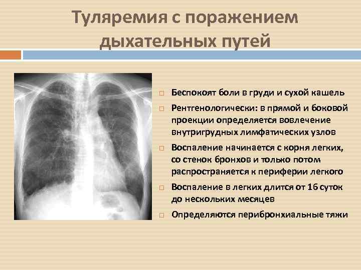 Легочный рисунок усилен за счет смешанного компонента что означает