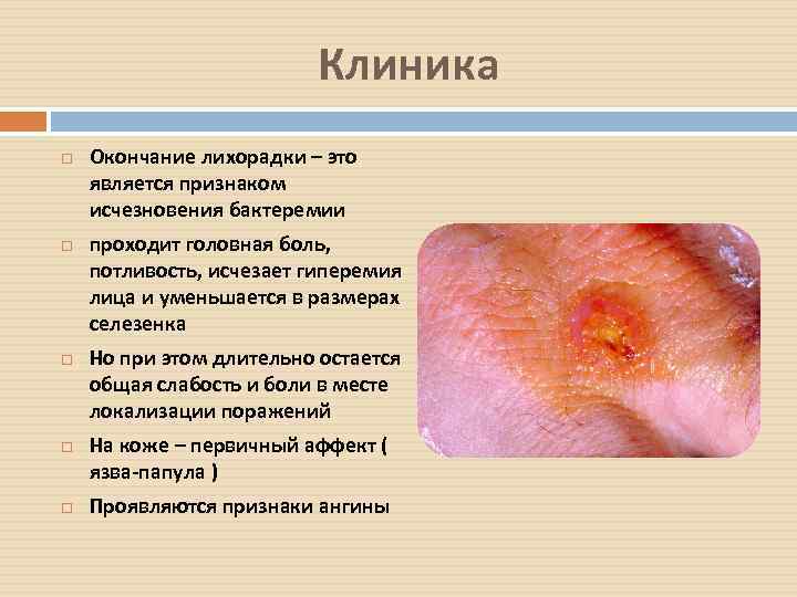 Клиника Окончание лихорадки – это является признаком исчезновения бактеремии проходит головная боль, потливость, исчезает