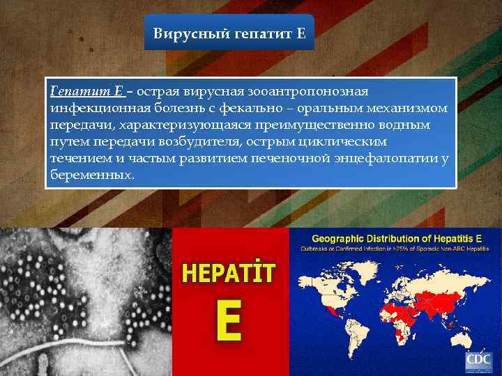 Вирусный гепатит Е Гепатит Е – острая вирусная зооантропонозная инфекционная болезнь с фекально –