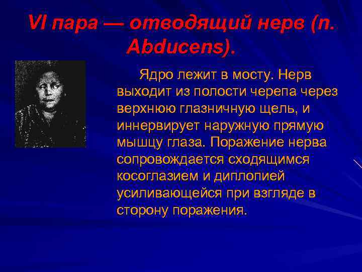 VI пара — отводящий нерв (n. Аbducens). Ядро лежит в мосту. Нерв выходит из