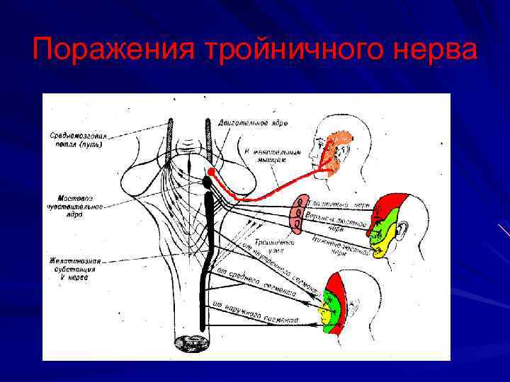 Поражения тройничного нерва 