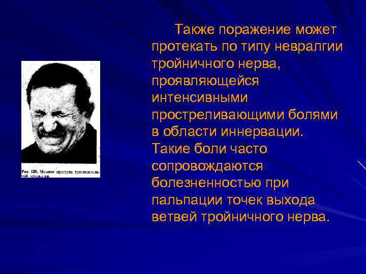 Также поражение может протекать по типу невралгии тройничного нерва, проявляющейся интенсивными простреливающими болями в
