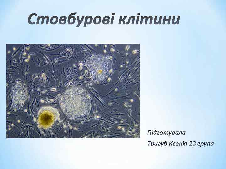 Підготувала Тригуб Ксенія 23 група 