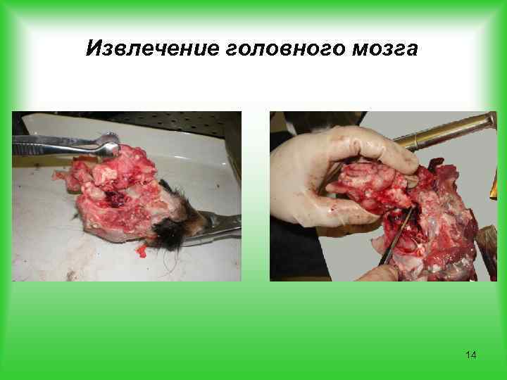 Извлечение головного мозга 14 