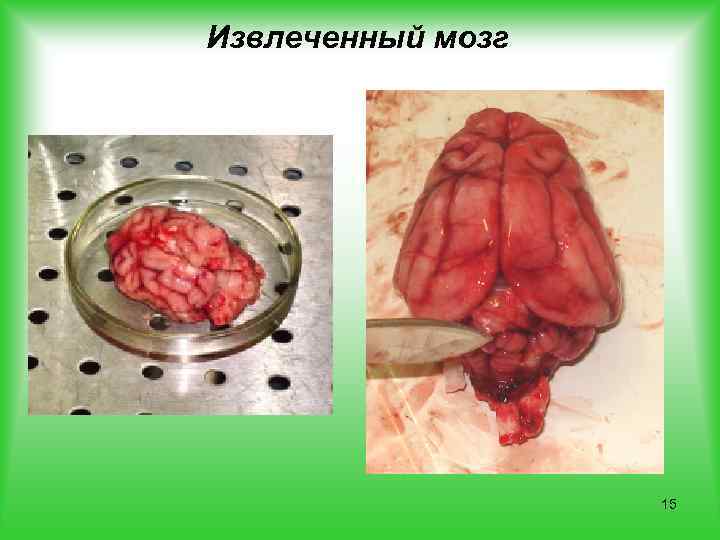 Извлеченный мозг 15 