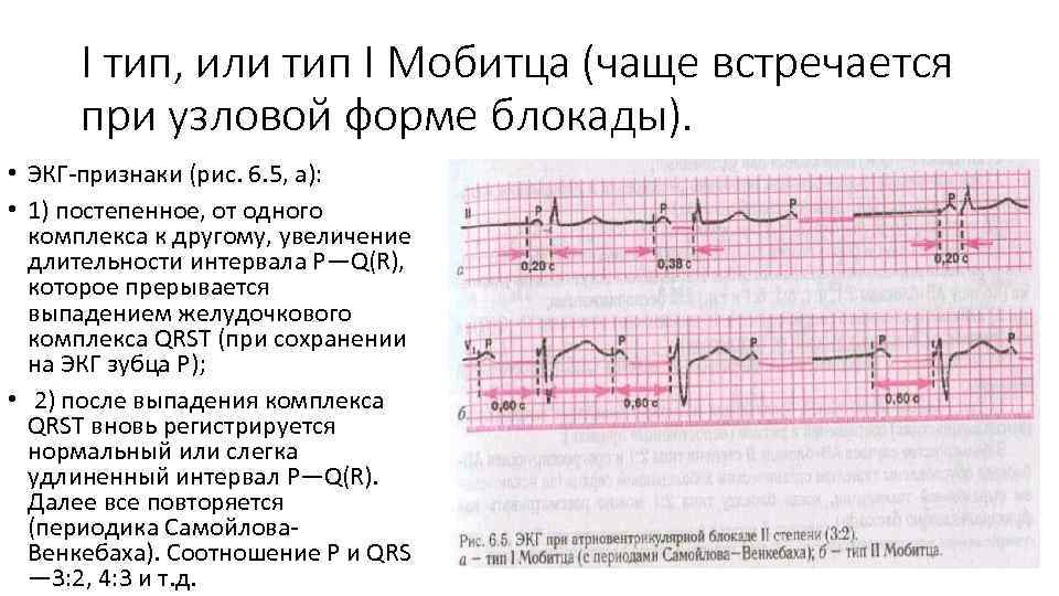 Ав блокада карта вызова