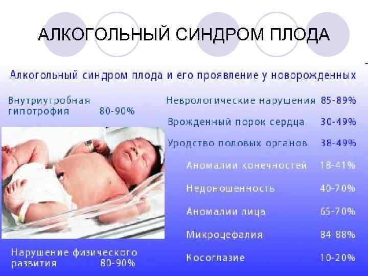 АЛКОГОЛЬНЫЙ СИНДРОМ ПЛОДА 