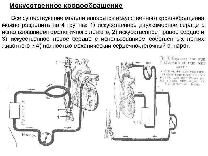 Искусственное кровообращение Все существующие модели аппаратов искусственного кровообращения можно разделить на 4 группы: 1)