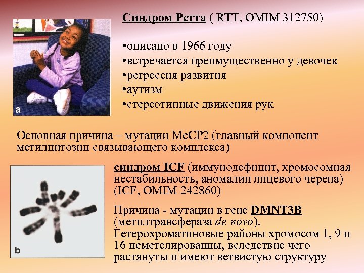 Синдром Ретта ( RTT, OMIM 312750) • описано в 1966 году • встречается преимущественно