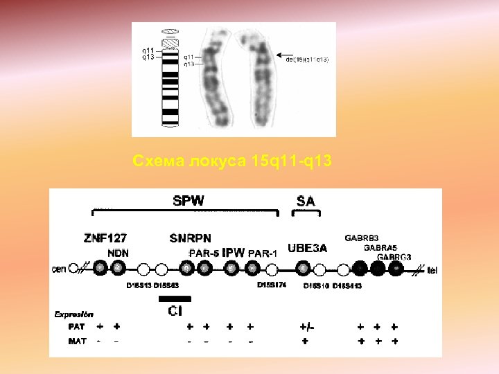 Схема локуса 15 q 11 -q 13 