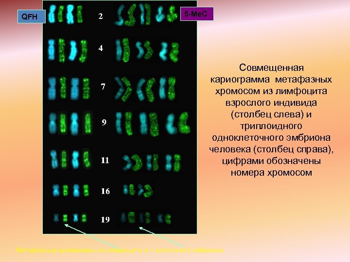 QFH 5 -Me. C Совмещенная кариограмма метафазных хромосом из лимфоцита взрослого индивида (столбец слева)