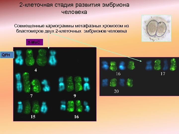 2 -клеточная стадия развития эмбриона человека Совмещенные кариограммы метафазных хромосом из бластомеров двух 2