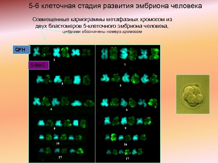 5 -6 клеточная стадия развития эмбриона человека Совмещенные кариограммы метафазных хромосом из двух бластомеров