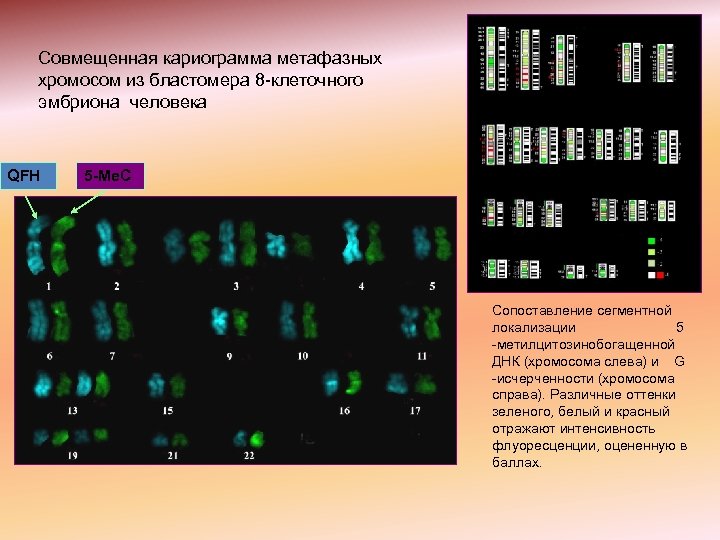 Совмещенная кариограмма метафазных хромосом из бластомера 8 -клеточного эмбриона человека QFH 5 -Me. C