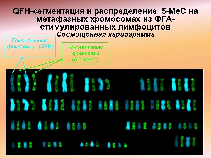 QFH-сегментация и распределение 5 -Mе. C на метафазных хромосомах из ФГАстимулированных лимфоцитов Гомологичные хромосомы