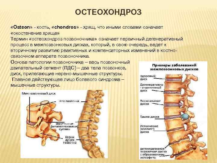 ОСТЕОХОНДРОЗ «Osteon» - кость, «chondros» - хрящ, что иными словами означает «окостенение хряща» Термин