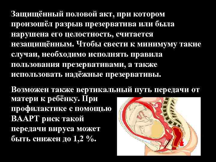 Защищённый половой акт, при котором произошёл разрыв презерватива или была нарушена его целостность, считается