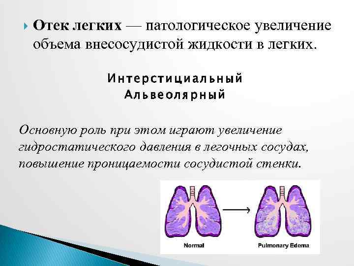 Патологическое усиление. Отек легких вызван увеличением количества крови. Интерстициальный и альвеолярный отек легких. Интерстициальный отек легких. Интерстициального и альвеолярного отека легкого.