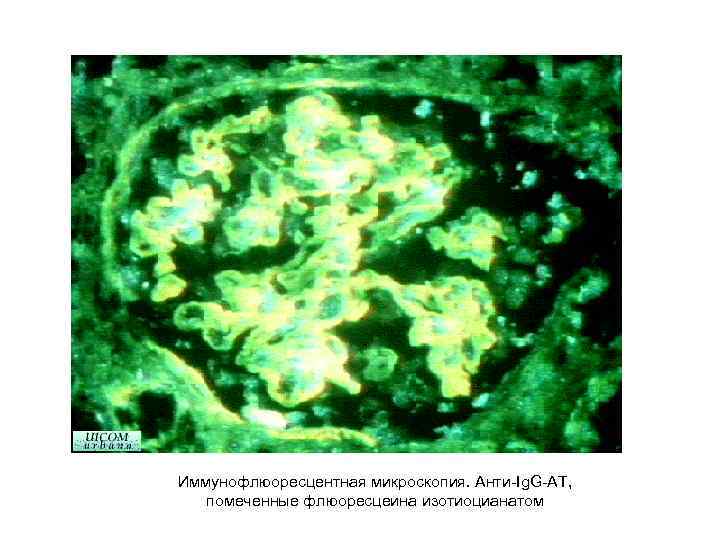 Иммунофлюоресцентная микроскопия. Анти-Ig. G-АТ, помеченные флюоресцеина изотиоцианатом 