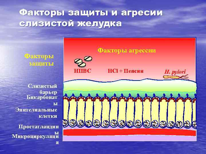 Факторы защиты и агресии слизистой желудка Факторы агрессии Факторы защиты НПВС Слизистый барьер Бикарбонат
