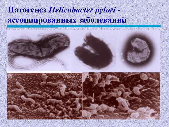 Патогенез Нelicobacter pylori ассоциированных заболеваний 