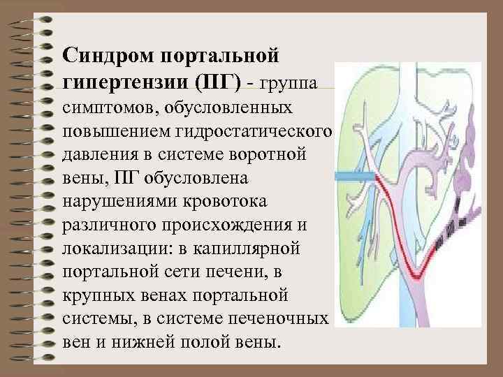 Синдром портальной гипертензии (ПГ) - группа симптомов, обусловленных повышением гидростатического давления в системе воротной