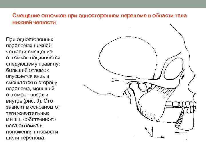 Классификация челюстно лицевых и лицевых протезов презентация