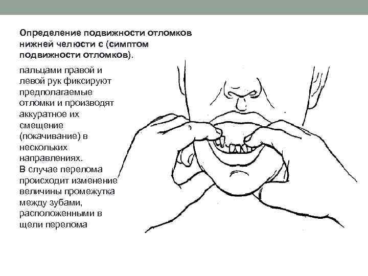 Схема классификация повреждений челюстно лицевой области