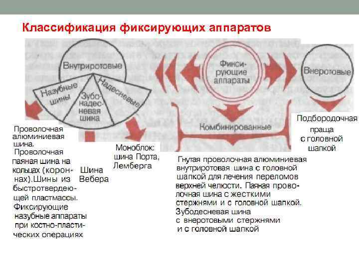 Классификация фиксирующих аппаратов 