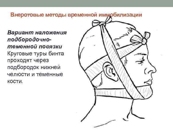 Методы временной и постоянной иммобилизации отломков челюстей презентация