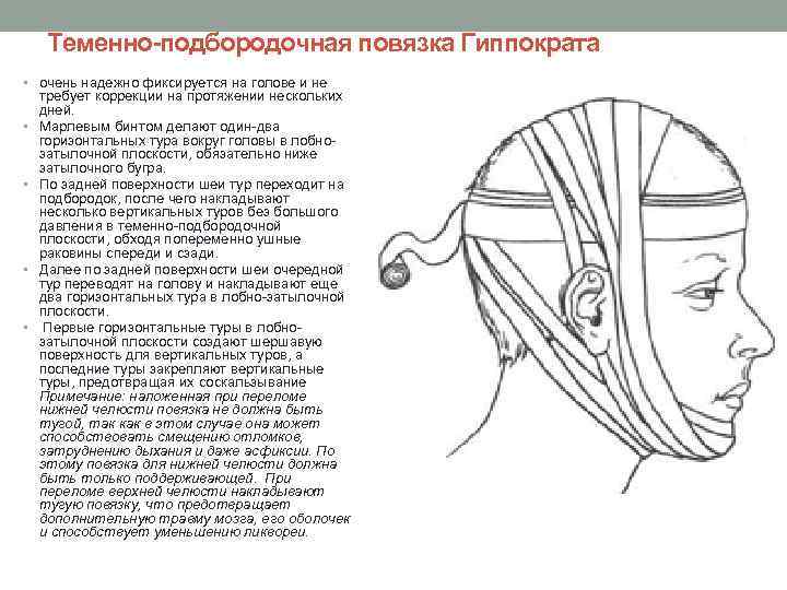 Повязка на голову чепец из бинта пошагово картинки с описанием