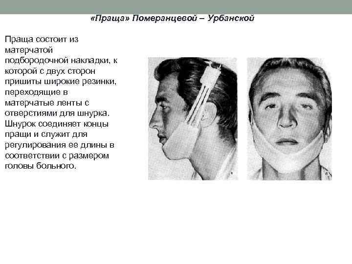  «Праща» Померанцевой – Урбанской Праща состоит из матерчатой подбородочной накладки, к которой с