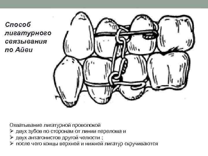 Лигатурная масса