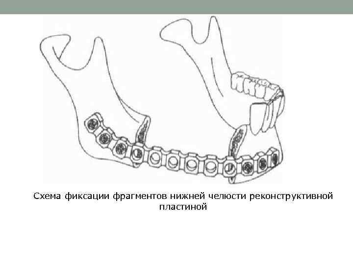 Классификация челюстно лицевых и лицевых протезов презентация