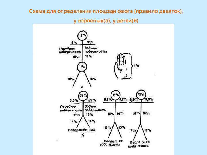 Схема для определения площади ожога (правило девяток), у взрослых(а), у детей(б) 