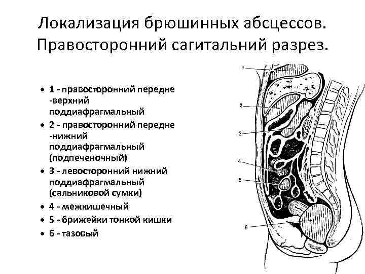 Схема формирования сальниковой сумки