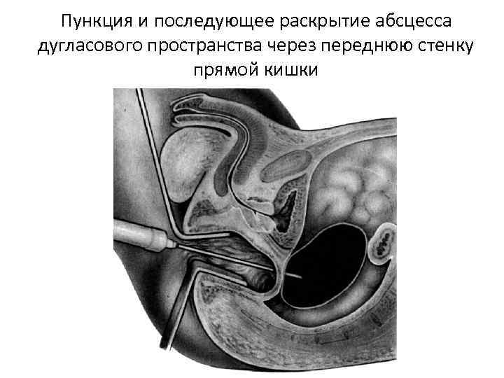 Дугласово пространство