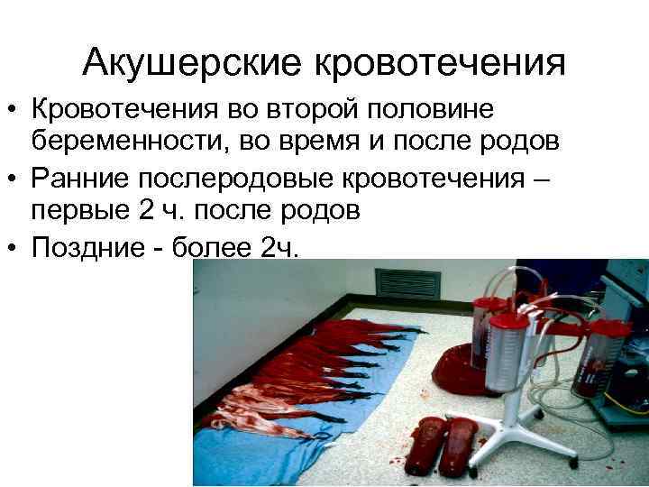 Акушерские кровотечения • Кровотечения во второй половине беременности, во время и после родов •