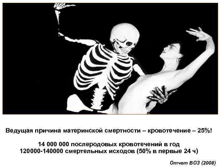 Ведущая причина материнской смертности – кровотечение – 25%! 14 000 послеродовых кровотечений в год